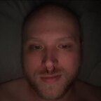 2baldheads