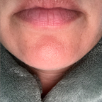 BigLips