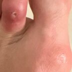 Real Runner Feet