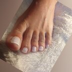 Romifeet