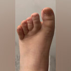 Stubby Nubby Toes