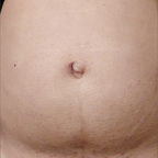 BellyNipplesArmpita