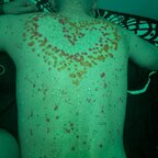 Fistude200