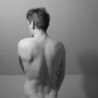 vitiligoboi